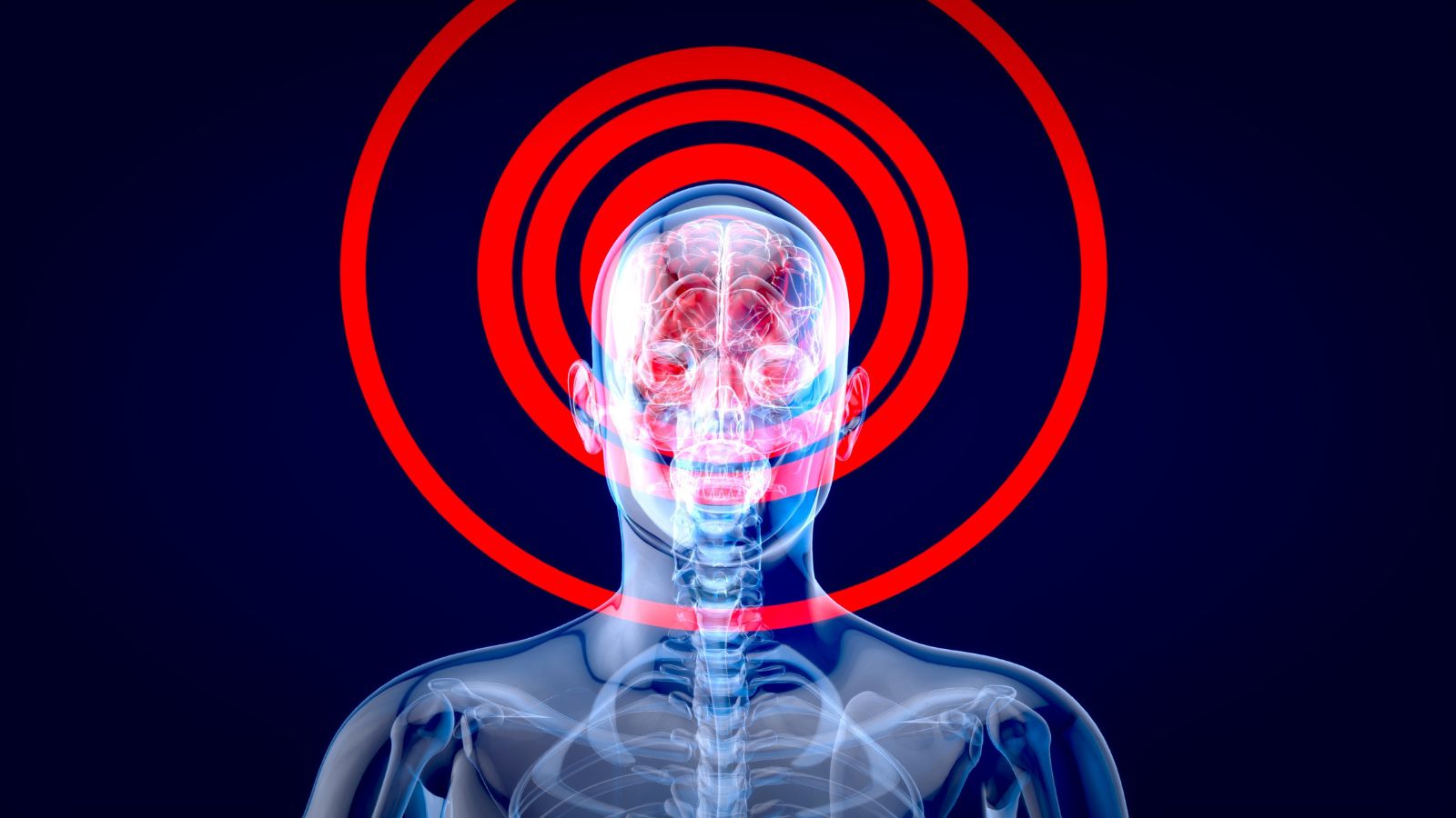Verzekeraars pleiten voor vroegere aanpak van psychisch verzuim